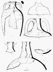 Амфорная тара: 1 &ndash; раскоп б, хоз. яма 1; 2 &ndash; хоз. яма 1 на эскарпе городища; 3-6 &ndash; помещение 5.